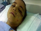 15 ba��bo� k�pe�in sald�rd��� minik G�lbahar yo�un bak�mda