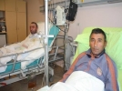 Yanan tek yumurta ikizine derisiyle hayat