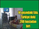 Kendi diyalizini kendi yap�yor