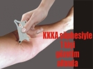 Kene alarm�