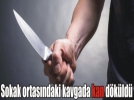 �vey karde�ler b��akla birbirlerini yaralad�