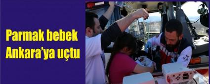 Parmak bebek helikopterle Ankara'ya g�nderildi