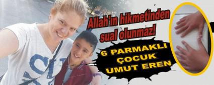 6 PARMAKLI �OCUK UMUT EREN