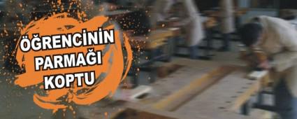 ��RENC�N�N PARMA�I KOPTU