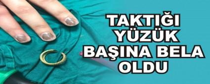 TAKTI�I Y�Z�K BA�INA BELA OLDU