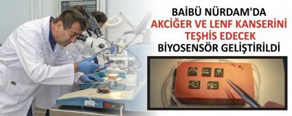BA�B� N�RDAM\'DA AKC��ER VE LENF KANSER�N� TE�H�S EDECEK B�YOSENS�R GEL��T�R�LD�